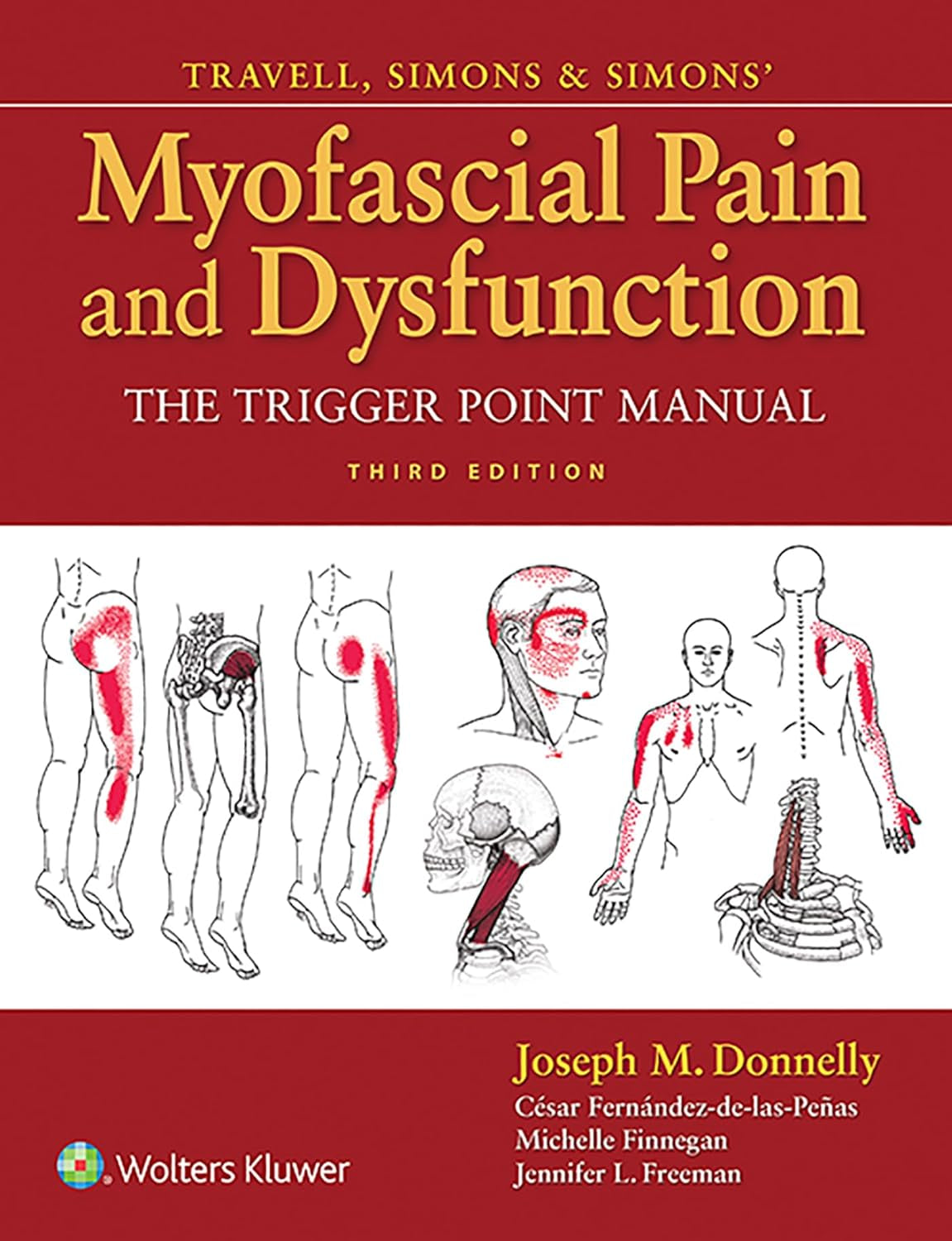 LWW - Travell, Simons & Simons' Myofascial Pain and Dysfunction: the Trigger Point Manual